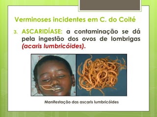 Verminoses incidentes em C. do Coité
3. ASCARIDÍASE: a contaminação se dá
pela ingestão dos ovos de lombrigas
(acaris lumbricóides).
Manifestação das ascaris lumbricóides
 