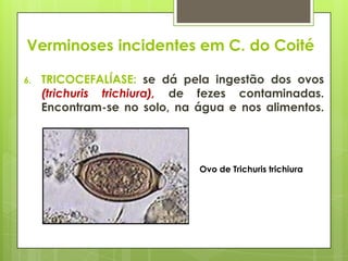 6. TRICOCEFALÍASE: se dá pela ingestão dos ovos
(trichuris trichiura), de fezes contaminadas.
Encontram-se no solo, na água e nos alimentos.
Ovo de Trichuris trichiura
Verminoses incidentes em C. do Coité
 