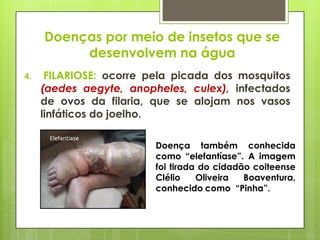 Doenças por meio de insetos que se
desenvolvem na água
4. FILARIOSE: ocorre pela picada dos mosquitos
(aedes aegyte, anopheles, culex), infectados
de ovos da filaria, que se alojam nos vasos
linfáticos do joelho.
Doença também conhecida
como “elefantíase”. A imagem
foi tirada do cidadão coiteense
Clélio Oliveira Boaventura,
conhecido como “Pinha”.
 