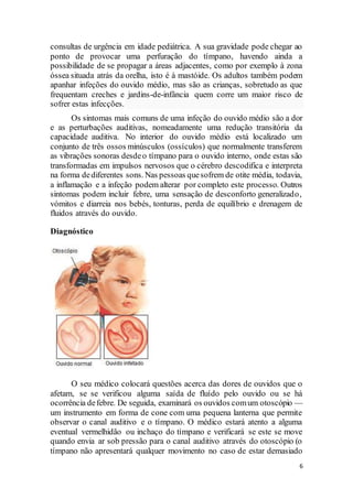 6
consultas de urgência em idade pediátrica. A sua gravidade pode chegar ao
ponto de provocar uma perfuração do tímpano, havendo ainda a
possibilidade de se propagar a áreas adjacentes, como por exemplo à zona
óssea situada atrás da orelha, isto é à mastóide. Os adultos também podem
apanhar infeções do ouvido médio, mas são as crianças, sobretudo as que
frequentam creches e jardins-de-infância quem corre um maior risco de
sofrer estas infecções.
Os sintomas mais comuns de uma infeção do ouvido médio são a dor
e as perturbações auditivas, nomeadamente uma redução transitória da
capacidade auditiva. No interior do ouvido médio está localizado um
conjunto de três ossos minúsculos (ossículos) que normalmente transferem
as vibrações sonoras desdeo tímpano para o ouvido interno, onde estas são
transformadas em impulsos nervosos que o cérebro descodifica e interpreta
na forma dediferentes sons. Nas pessoas quesofrem de otite média, todavia,
a inflamação e a infeção podem alterar por completo este processo. Outros
sintomas podem incluir febre, uma sensação de desconforto generalizado,
vómitos e diarreia nos bebés, tonturas, perda de equilíbrio e drenagem de
fluidos através do ouvido.
Diagnóstico
O seu médico colocará questões acerca das dores de ouvidos que o
afetam, se se verificou alguma saída de fluído pelo ouvido ou se há
ocorrência defebre. De seguida, examinará os ouvidos comum otoscópio —
um instrumento em forma de cone com uma pequena lanterna que permite
observar o canal auditivo e o tímpano. O médico estará atento a alguma
eventual vermelhidão ou inchaço do tímpano e verificará se este se move
quando envia ar sob pressão para o canal auditivo através do otoscópio (o
tímpano não apresentará qualquer movimento no caso de estar demasiado
 