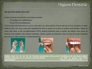 Que tipo de fio dentário devo usar? Existem dois tipos de fio dentário que podemos escolher: Fio de Nylon (ou multifilamentar)  Fio de PTFE (monofilamentar)  O fio de nylon está disponível com cera ou sem cera e em vários sabores. Porque este tipo de fio é composto por várias fiadas de nylon, por vezes, pode partir, especialmente entre os dentes com pontos de contacto muito estreitos. Apesar de serem mais caros, os fios monofilamentados (PTFE) deslizam facilmente entre os dentes, até mesmo, entre pontos de contacto muito estreitos e são bastante resistentes. Quando usados correctamente, ambos os tipos de fio são excelentes para remover a placa bacteriana e restos alimentares.   Patrícia S. Lopes Utilize cerca de 45 cm de fio dentário, deixando 3 ou 4 cm de fio para trabalhar. Envolva, suavemente, o fio na curva dos seus dentes. Certifique-se de que limpou abaixo da linha da gengiva mas evite lacerar as gengivas com o fio. 