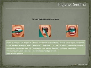 Técnica de Escovagem Correcta Patrícia S. Lopes Incline a escova a um ângulo de 45º de encontro à gengiva a faça movimentos horizontais, tipo vai-vem ou circulares, com a escova a partir da linha gengival. Escove suavemente as superfícies exteriores, interiores e de mastigação dos dentes fazendo movimentos curtos tipo vai-vem. Escove a sua língua suavemente de modo a remover as bactérias e a refrescar o seu hálito. 
