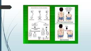 Higiene postural