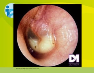 Tomado de: http://www.salud.uncomo.com
 