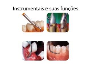 Instrumentais e suas funções
 