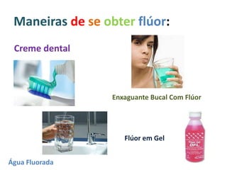 Maneiras de se obter flúor:
Creme dental
Enxaguante Bucal Com Flúor
Flúor em Gel
Água Fluorada
 