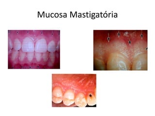 Mucosa Mastigatória
 