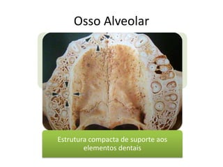 Osso Alveolar
Estrutura compacta de suporte aos
elementos dentais
 