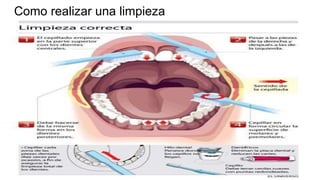 Como realizar una limpieza
 