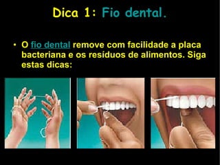 Dica 1:  Fio   dental. O   fio dental   remove com facilidade a placa bacteriana e os resíduos de alimentos. Siga estas dicas:  