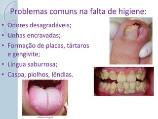 Problemas comuns na falta de higiene:
• Odores desagradáveis;
• Unhas encravadas;
• Formação de placas, tártaros
e gengivite;
• Língua saburrosa;
• Caspa, piolhos, lêndias.
 