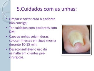 5.Cuidados com as unhas:
• Limpar e cortar caso o paciente
não consiga;
Ter cuidados com pacientes com
DM;
Caso as unhas sejam duras,
colocar imersas em água morna
durante 10-15 min.
Desaconselhável o uso do
esmalte em clientes pré-
cirurgicos.
•
•
•
 