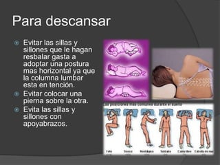 Para descansar
 Evitar las sillas y
sillones que le hagan
resbalar gasta a
adoptar una postura
mas horizontal ya que
la columna lumbar
esta en tención.
 Evitar colocar una
pierna sobre la otra.
 Evita las sillas y
sillones con
apoyabrazos.
 