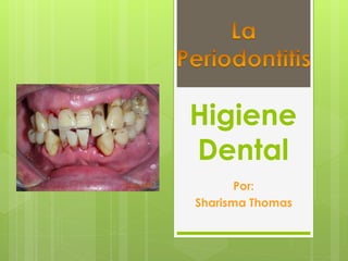 Higiene 
Dental 
Por: 
Sharisma Thomas 
 