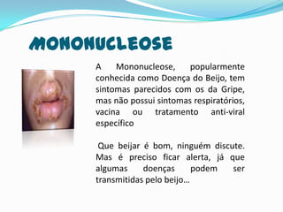 MononucleoseA Mononucleose, popularmente conhecida como Doença do Beijo, tem sintomas parecidos com os da Gripe, mas não possui sintomas respiratórios, vacina ou tratamento anti-viral específico Que beijar é bom, ninguém discute. Mas é preciso ficar alerta, já que algumas doenças podem ser transmitidas pelo beijo…