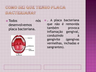  Todos          nós      . A placa bacteriana
 desenvolvemos             que não é removida
 placa bacteriana.         também         provoca
                           inflamação gengival,
                           conduzindo           à
                           gengivite    (gengivas
                           vermelhas, inchadas e
                           sangrantes).
 
