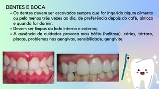 Os dentes devem ser escovados sempre que for ingerido algum alimento
ou pelo menos três vezes ao dia, de preferência depois do café, almoço
e quando for dormir.
Devem ser limpos do lado interno e externo;
A ausência de cuidados provoca mau hálito (halitose), cáries, tártaro,
placas, problemas nas gengivas, sensibilidade, gengivite.
DENTES E BOCA
 