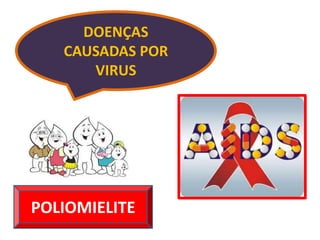 DOENÇAS
   CAUSADAS POR
      VIRUS




POLIOMIELITE
 
