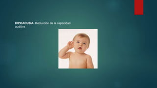 HIPOACUSIA. Reducción de la capacidad 
auditiva 
 