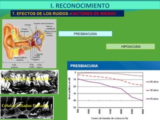 Células Ciliadas Normales
Células Ciliadas Dañadas
I. RECONOCIMIENTO
7. EFECTOS DE LOS RUIDOS -FACTORES DE RIESGO
PRESBIACUSIA
HIPOACUSIA
 