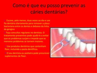 Como é que eu posso prevenir as cáries dentárias? 1-  Escove, pelo menos, duas vezes ao dia e use fio dentário diariamente para remover a placa bacteriana entre os dentes e debaixo da linha da gengiva 2- Faça consultas regulares no dentista. O tratamento preventivo pode ajudá-lo a evitar que os problemas surjam e impede que os menores problemas se tornem maiores.  3- Use produtos dentários que contenham flúor, incluindo a pasta dentífrica. 4- O seu dentista ou pediatra pode prescrever suplementos de flúor.  