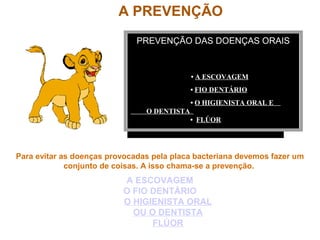 A PREVENÇÃO
PREVENÇÃO DAS DOENÇAS ORAIS
• A ESCOVAGEM
• FIO DENTÁRIO
• O HIGIENISTA ORAL E
O DENTISTA
• FLÚOR
Para evitar as doenças provocadas pela placa bacteriana devemos fazer um
conjunto de coisas. A isso chama-se a prevenção.
A ESCOVAGEM
O FIO DENTÁRIO
O HIGIENISTA ORAL
OU O DENTISTA
FLÚOR
 