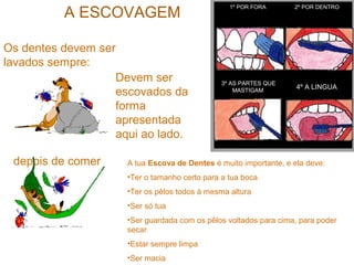 A ESCOVAGEM
1º POR FORA 2º POR DENTRO
3º AS PARTES QUE
MASTIGAM
4º A LINGUA
Os dentes devem ser
lavados sempre:
depois de comer
Devem ser
escovados da
forma
apresentada
aqui ao lado.
A tua Escova de Dentes é muito importante, e ela deve:
•Ter o tamanho certo para a tua boca
•Ter os pêlos todos à mesma altura
•Ser só tua
•Ser guardada com os pêlos voltados para cima, para poder
secar
•Estar sempre limpa
•Ser macia
 