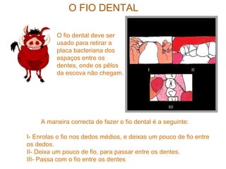 O FIO DENTAL
I II
III
O fio dental deve ser
usado para retirar a
placa bacteriana dos
espaços entre os
dentes, onde os pêlos
da escova não chegam.
A maneira correcta de fazer o fio dental é a seguinte:
I- Enrolas o fio nos dedos médios, e deixas um pouco de fio entre
os dedos.
II- Deixa um pouco de fio, para passar entre os dentes.
III- Passa com o fio entre os dentes
 