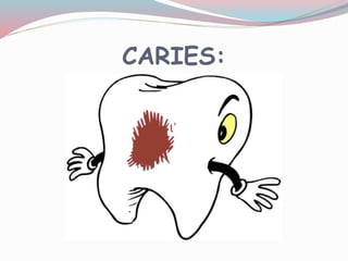 CARIES:
 