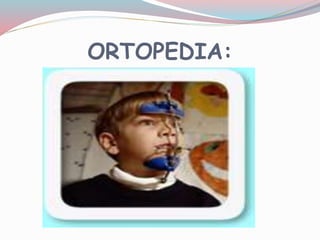 ORTOPEDIA:
 