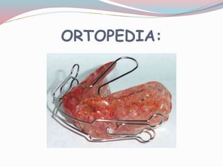 ORTOPEDIA:
 