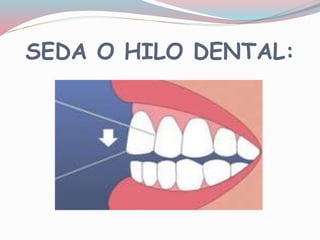 SEDA O HILO DENTAL:
 