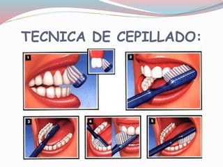 TECNICA DE CEPILLADO:
 