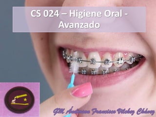 CS 024 – Higiene Oral -
Avanzado
 