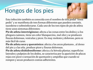 Hongos de los pies
Esta infección también es conocida con el nombre de tiña podal "tinea
pedis" y se manifiesta de tres formas diferentes que pueden coexistir,
sucederse o sobreinfectarse. Cada uno de los tres tipos de pie de atleta
tiene unos sintomas diferentes:
Pie de atleta intertriginoso: afecta a las zonas entre los dedos y a los
pliegues cuáneos, tiene un color blanquecino, mal olor y se producen
fisuras dolorosas, vesículas y picor. Es muy molesto y doloroso, pero es
más fácil de curar.
Pie de atleta seco y queratósico: afecta a los arcos plantares , al dorso
del pie y a las uña, produce picor y fisuras dolorosas.
Pie de atleta dishidrosiforme: afecta a la bóveda plantar, superficies
laterales y pulpejos de los dedos, se caracteriza por la aparición de placas
rojas con picor o sensación de quemazón y ampollas que cuando se
rompen y secan producen costras adherentes.
 