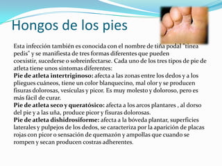 Hongos de los pies
Esta infección también es conocida con el nombre de tiña podal "tinea
pedis" y se manifiesta de tres formas diferentes que pueden
coexistir, sucederse o sobreinfectarse. Cada uno de los tres tipos de pie de
atleta tiene unos sintomas diferentes:
Pie de atleta intertriginoso: afecta a las zonas entre los dedos y a los
pliegues cuáneos, tiene un color blanquecino, mal olor y se producen
fisuras dolorosas, vesículas y picor. Es muy molesto y doloroso, pero es
más fácil de curar.
Pie de atleta seco y queratósico: afecta a los arcos plantares , al dorso
del pie y a las uña, produce picor y fisuras dolorosas.
Pie de atleta dishidrosiforme: afecta a la bóveda plantar, superficies
laterales y pulpejos de los dedos, se caracteriza por la aparición de placas
rojas con picor o sensación de quemazón y ampollas que cuando se
rompen y secan producen costras adherentes.
 