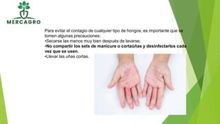 Para evitar el contagio de cualquier tipo de hongos, es importante que se
tomen algunas precauciones:
•Secarse las manos muy bien después de lavarse.
•No compartir los sets de manicure o cortaúñas y desinfectarlos cada
vez que se usen.
•Llevar las uñas cortas.
 