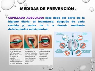 MEDIDAS DE PREVENCIÓN .
• CEPILLADO ADECUADO: éste debe ser parte de la
higiene diaria, al levantarse, después de cada
comida y, antes de ir a dormir. mediante
determinados movimientos:
 