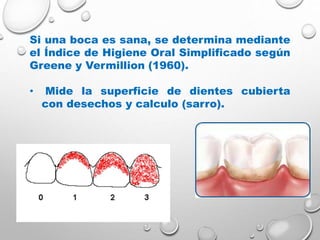 Si una boca es sana, se determina mediante
el Índice de Higiene Oral Simplificado según
Greene y Vermillion (1960).
• Mide la superficie de dientes cubierta
con desechos y calculo (sarro).
 