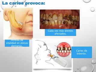 La caries provoca:
Pérdida de
vitalidad en piezas
dentarias.
Cada vez más dientes
afectados.
Caries de
biberón.
 