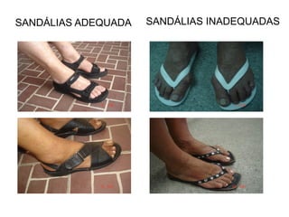 SANDÁLIAS ADEQUADA SANDÁLIAS INADEQUADAS   