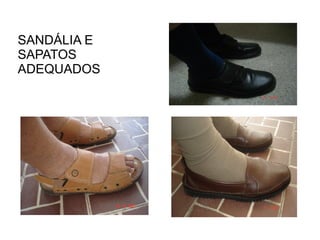SANDÁLIA E SAPATOS ADEQUADOS 