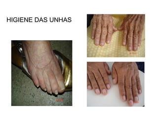 HIGIENE DAS UNHAS 