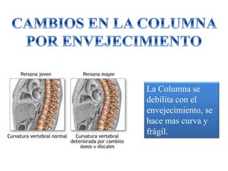 La Columna se
debilita con el
envejecimiento, se
hace mas curva y
frágil.
 