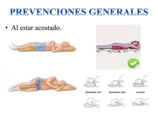 • Al estar acostado.
 