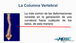 La más común de las deformaciones
consiste en la generación de una
curvatura hacia cualquier de los
lados, de esta manera:
 