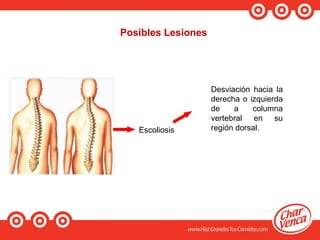 Posibles Lesiones
Escoliosis
Desviación hacia la
derecha o izquierda
de a columna
vertebral en su
región dorsal.
 