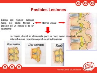 Hernia Discal
Salida del núcleo pulposo
fuera del anillo fibroso y
presión de un nervio o de un
ligamento
La hernia discal se desarrolla poco a poco como resultado de
sobresfuerzos repetidos o posturas inadecuadas
 