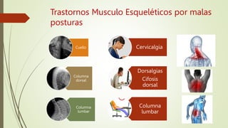 Trastornos Musculo Esqueléticos por malas
posturas
Cuello
Columna
dorsal
Columna
lumbar
Cervicalgia
Dorsalgias
Cifosis
dorsal
Columna
lumbar
 