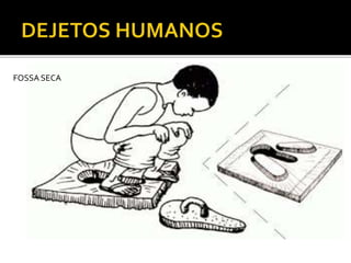 FOSSA SECA 
 